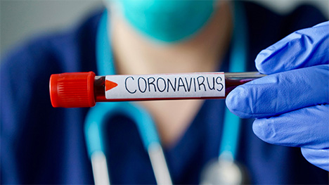 TV5 programme deux émissions spéciales sur le coronavirus cette semaine